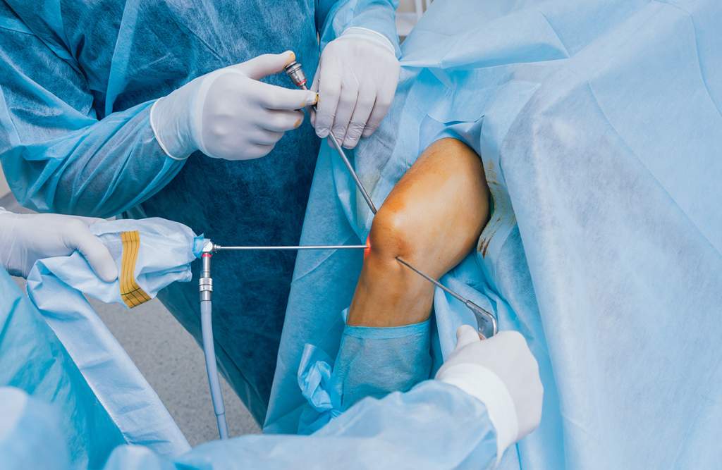 Best Knee Arthroscopy in Raichur, Knee Arthroscopy, Dr vishal Patil